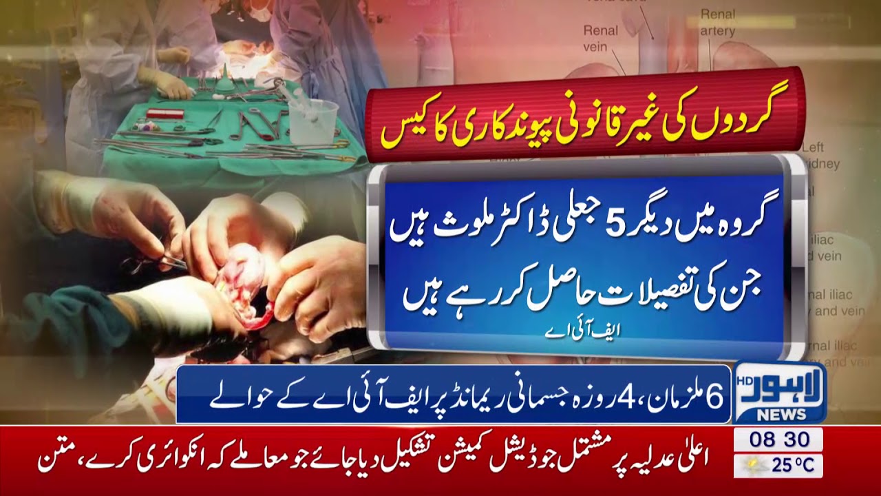 Illegal kidney transplant case: 6 suspects sent to FIA on physical remand