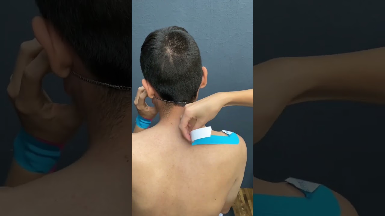 Dolor de cuello #cuello #dolor #estres #vendajeneuromuscular
