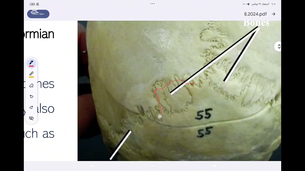 oral pathology lec genetic and metabolic diseases of bone مرحلة رابعة طب اسنان