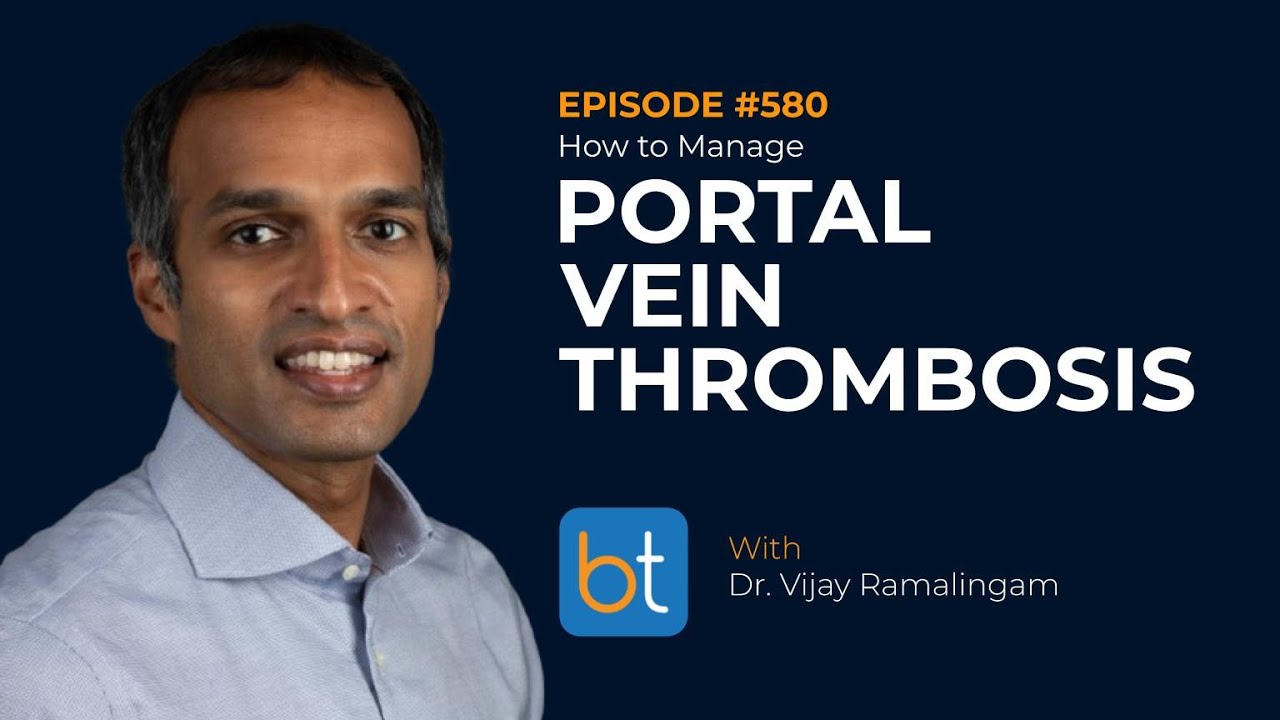 How to Manage Portal Vein Thrombosis w/ Dr. Vijay Ramalingam | BackTable Podcast Ep. 580
