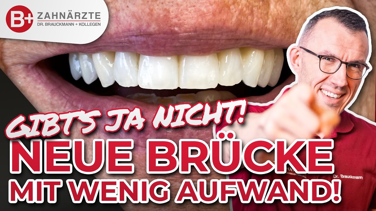 Ganz einfach: Zahnbrücke unkompliziert neu gemacht! Brücke für die Frontzähne mit Vorher-Nachher!
