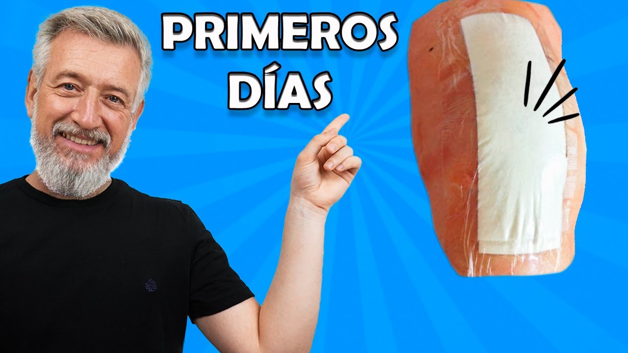🦵 Primera Semana con PRÓTESIS de RODILLA Cómo reducir el DOLOR y la inflamación