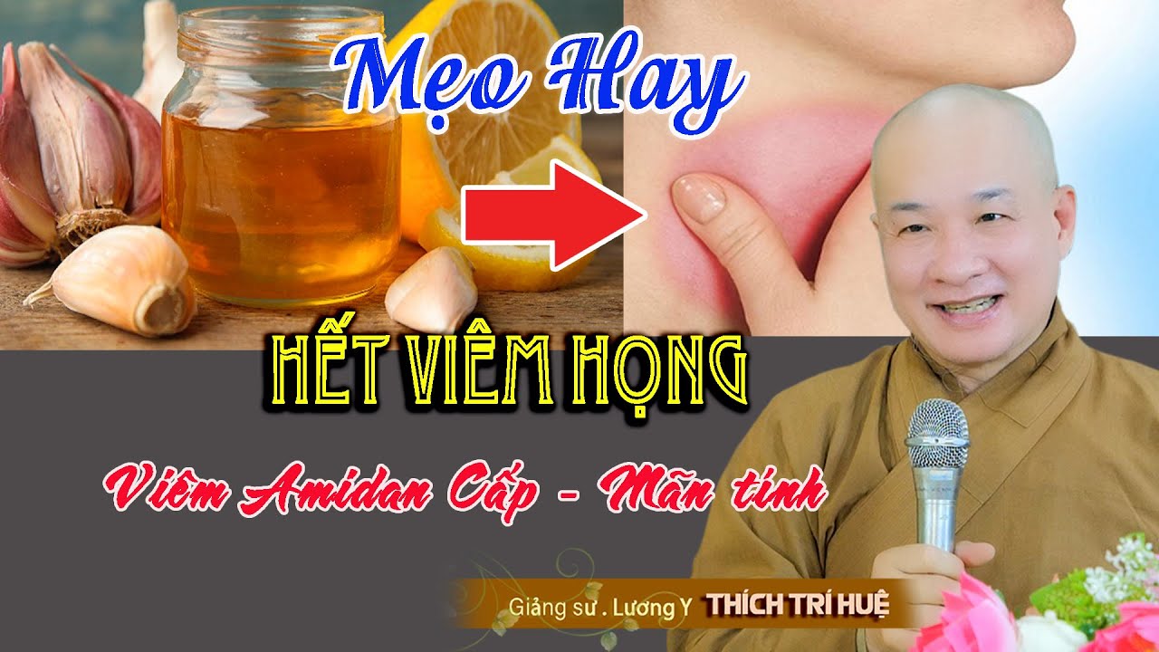 Bí Quyết hay trị Viêm Họng, Viêm Amidan không cần dùng thuốc - Chùa Pháp Tạng. Thầy Thích Trí Huệ