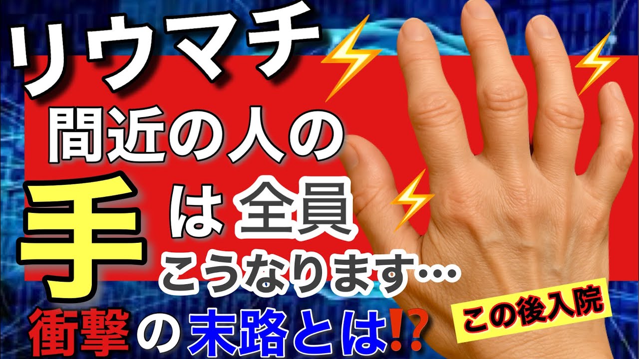 【最新研究】リウマチの原因がついに判明！膠原病を改善したいなら〇〇が大事！