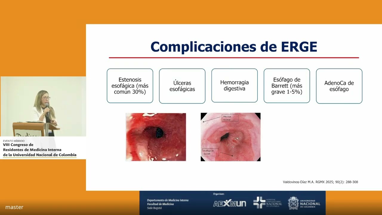 Enfermedad por reflujo gastroesofagico