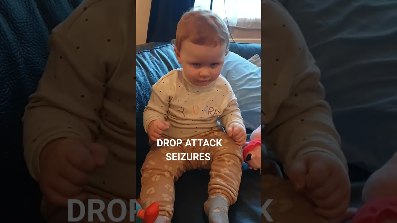 hopes start of head drop/drop attack seizures aged 9 months