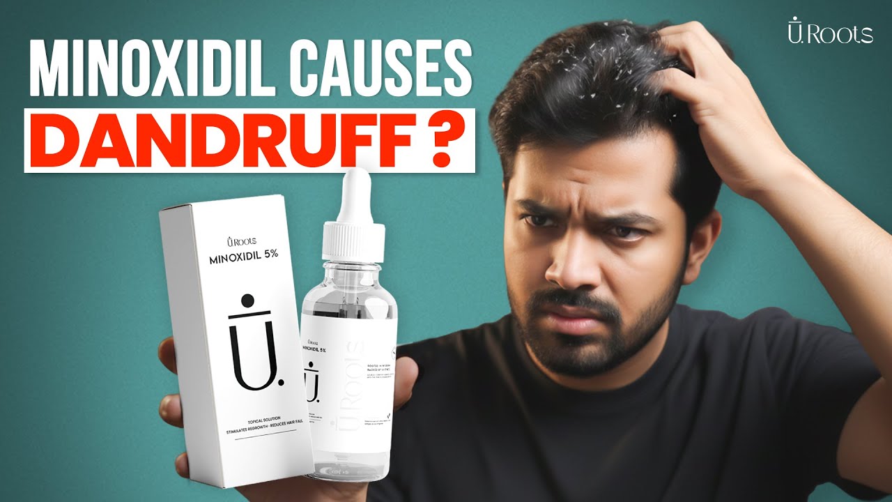 Why Minoxidil cause Dandruff | Minoxidil Causes Dandruff | Minoxidil For Hair | #minoxidil #uroots