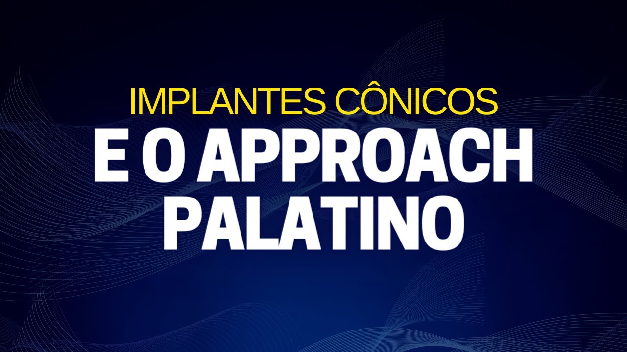 IMPLANTES CÔNICOS E O APPROACH PALATINO