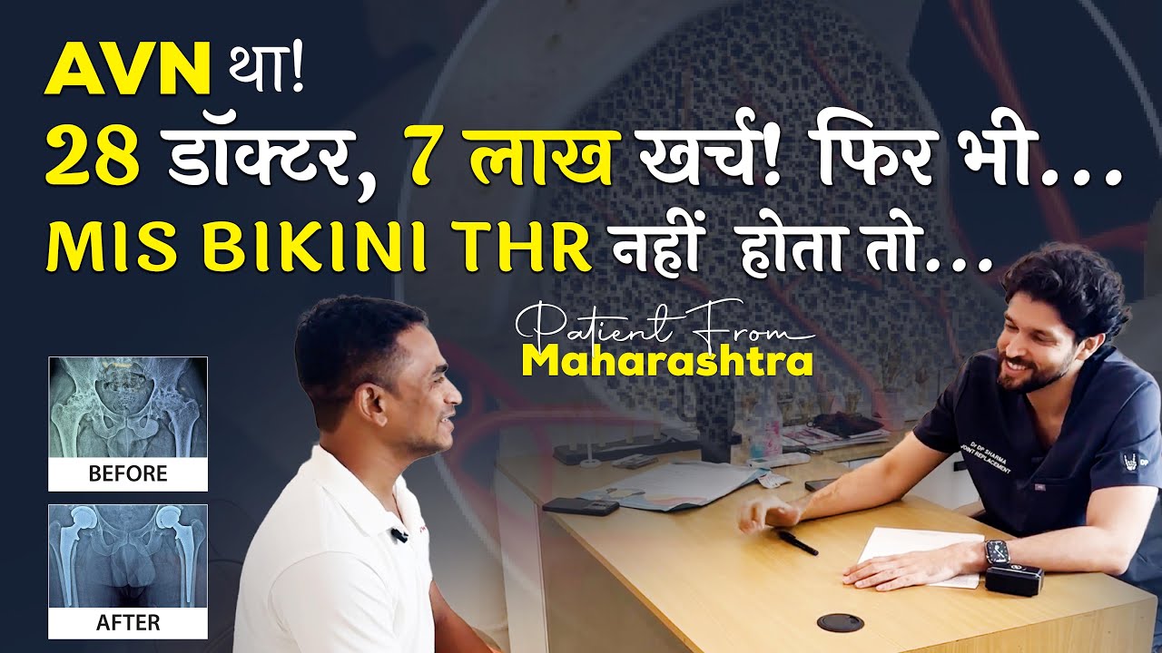 Hip AVN Treatment By MIS BIKINI Bilateral DAA THR Of A Patient From Maharashtra - Dr DP Sharma