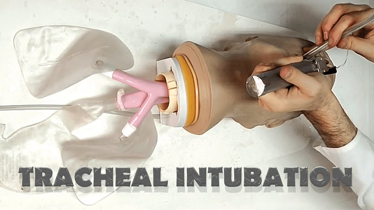 Tracheal tube placement | INTUBATION