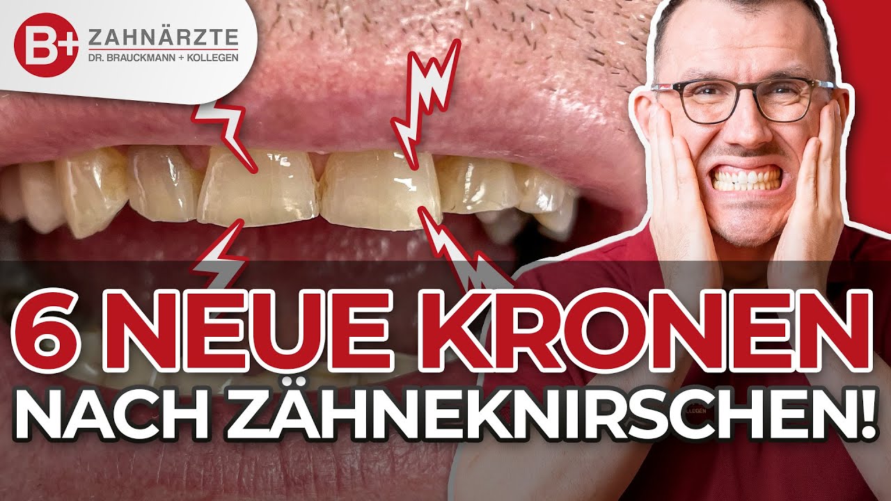 Bruxismus & Zähneknirschen - Zahnkronen retten das Lächeln des Patienten!