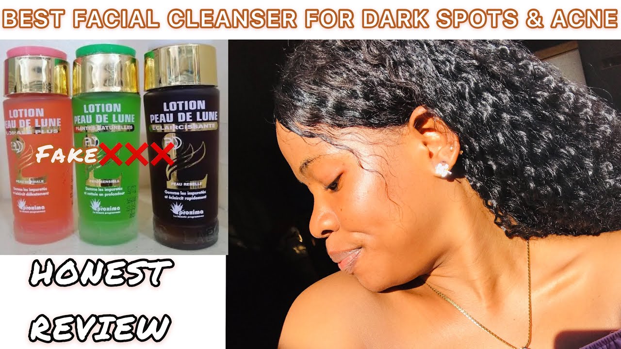 BEST FACIAL CLEANSER FOR DARK SPOT AND ACNE: Lotion Peau De Lune Florale Plus Review + Get Rid Of