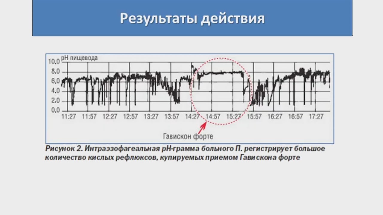 Мельников К.Н. Средства, влияющие на ЖКТ