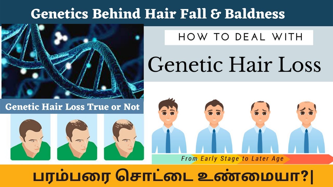 Genetics Behind Hair Fall & Baldness | பரம்பரை சொட்டை உண்மையா? | Genetic Hair Loss True or Not ?