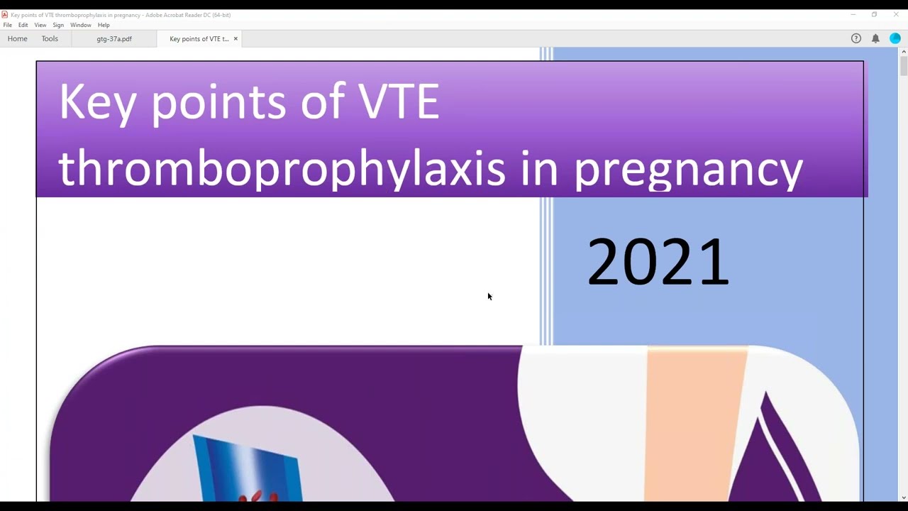 RCOG VTE Prophylaxis and acute management