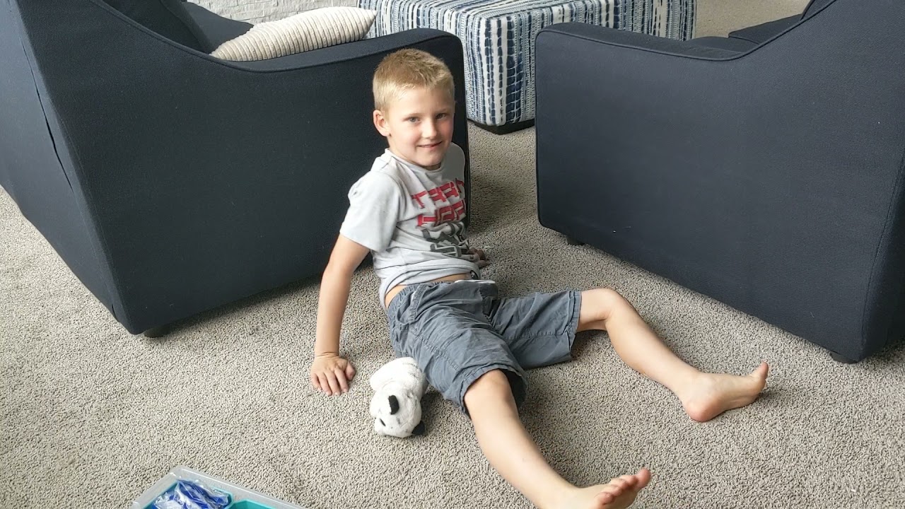 Tutorial - Inserting Dexcom G6 Sensor Into Abdomen of 6-yr-Old Child - Stomach Site Insertion Belly