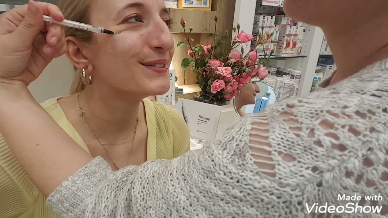 ΥΑΛΟΥΡΟΝΙΚΟ ΧΩΡΙΣ ΕΝΕΣΕΙΣ ΘΕΡΑΠΕΙΑ ΠΡΟΣΩΠΟΥ ΜΕ ΥΑΛΟΥΡΟΝΙΚΟ ΟΞΥ-ΜΕΘΟΔΟΣ FILLERINA