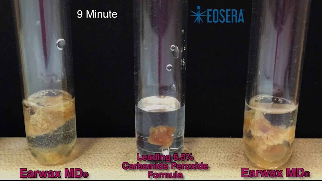 Earwax MD&reg; vs. 6.5% Carbamide Peroxide
