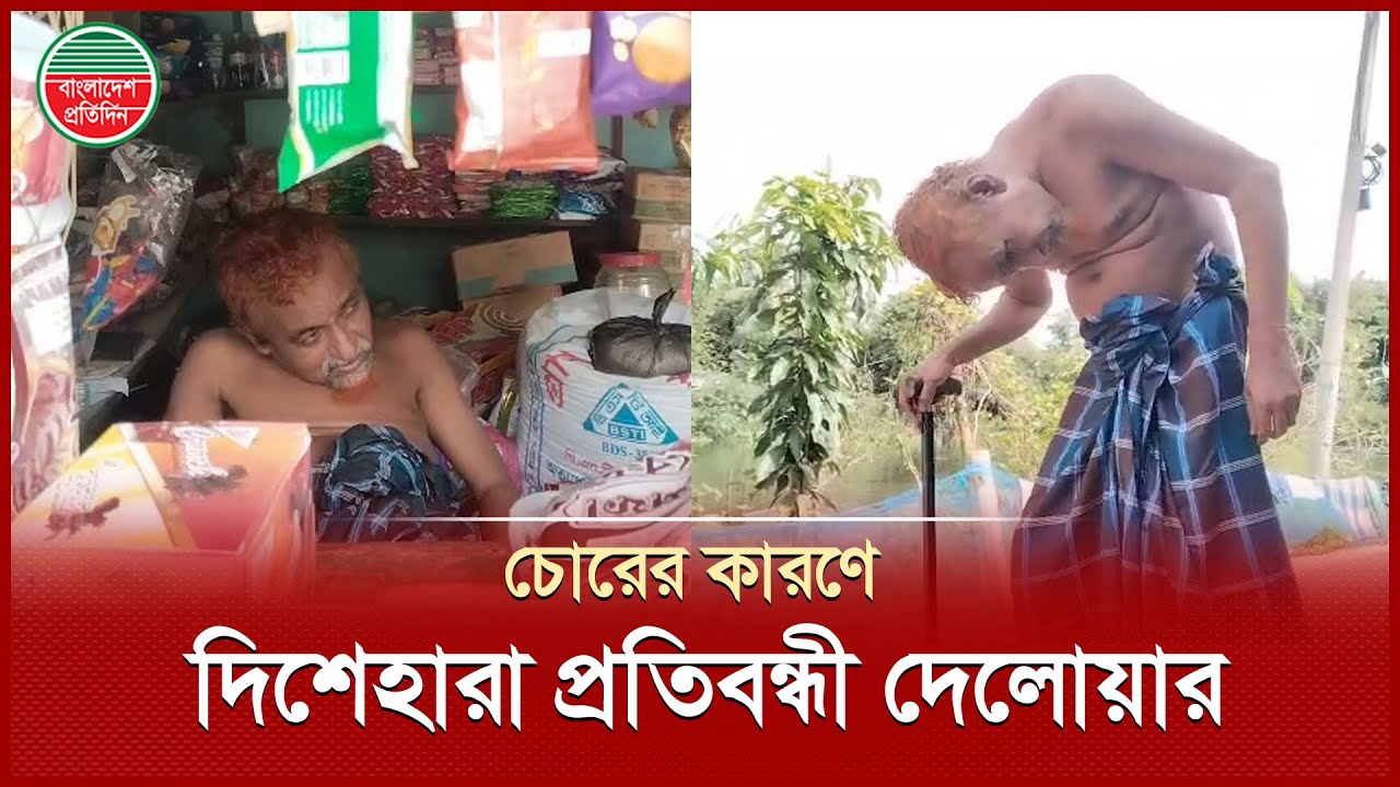 শারীরিক প্রতিবন্ধকতা জয় করলেও চোরের কারণে দিশেহারা দেলোয়ার হোসেন | Physical Disability | Cumilla