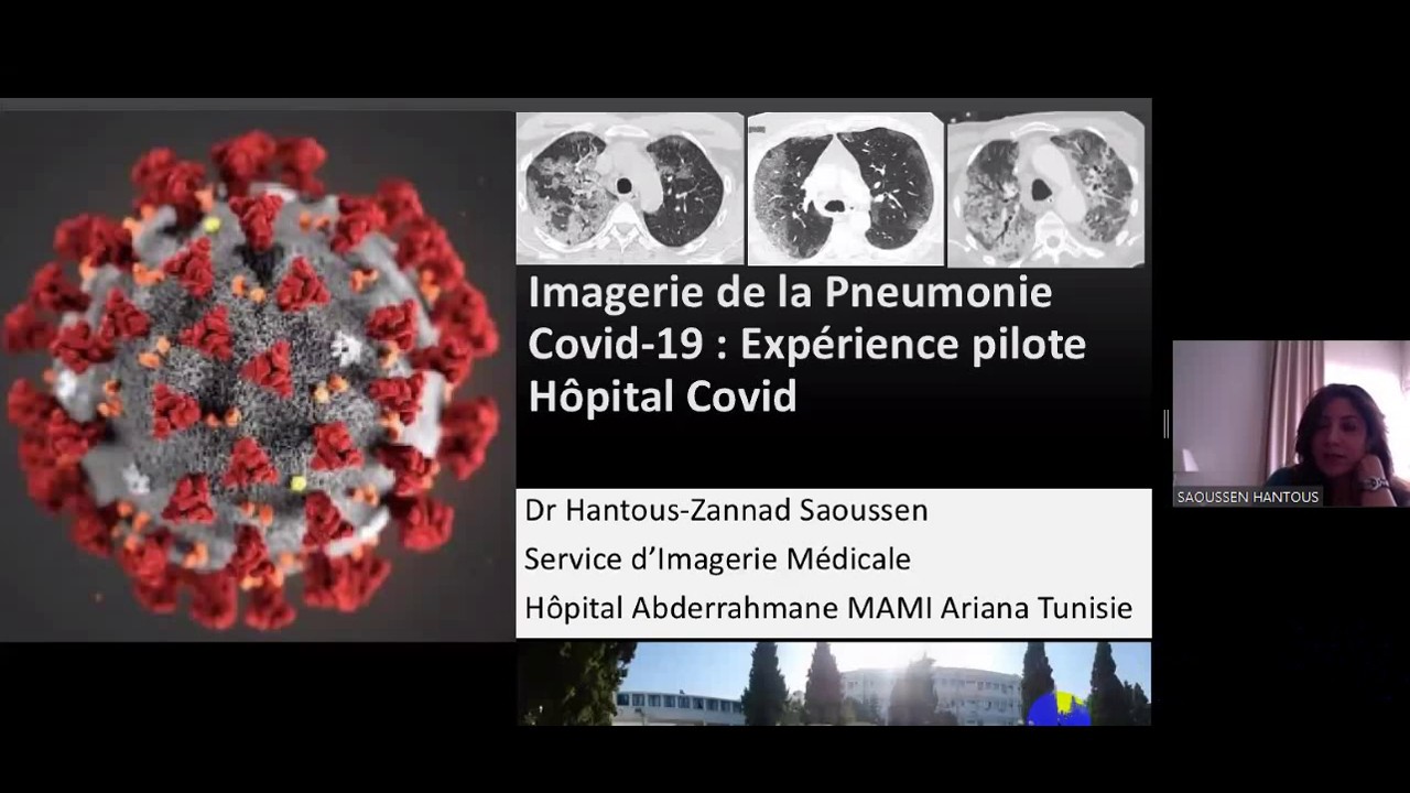Apports de la TDM dans le diagnostic Covid+ - Expérience Pilote d'un Hopital Covid - MEDITHON 19
