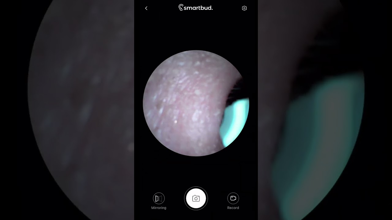 Ear cleaner with a camera!