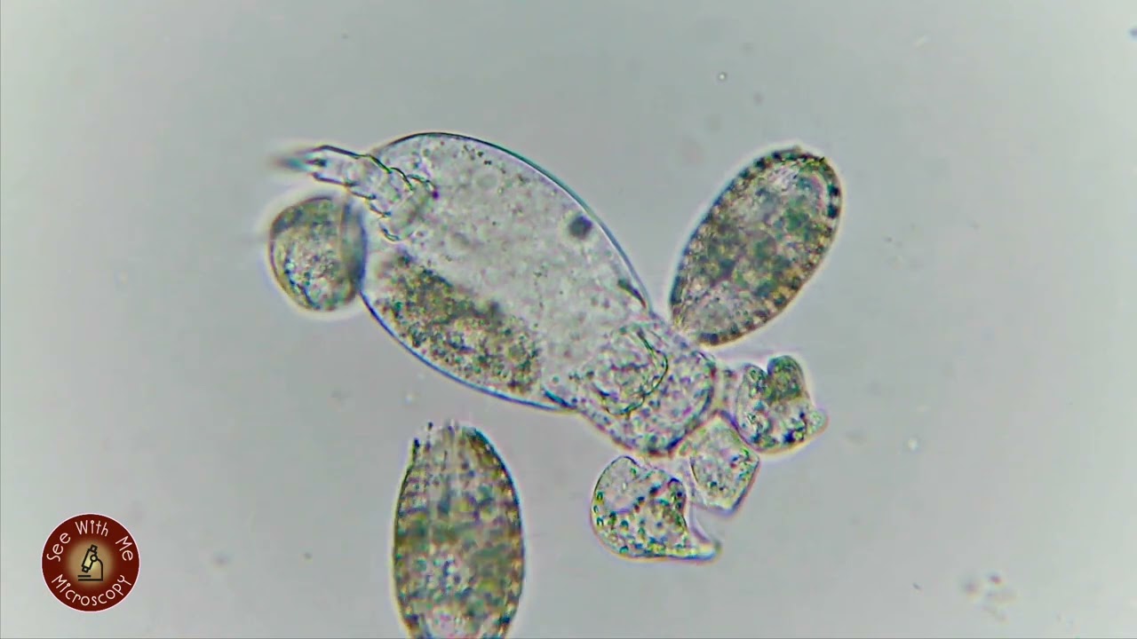 Scavengers starring Coleps Hirtus and Euglenids