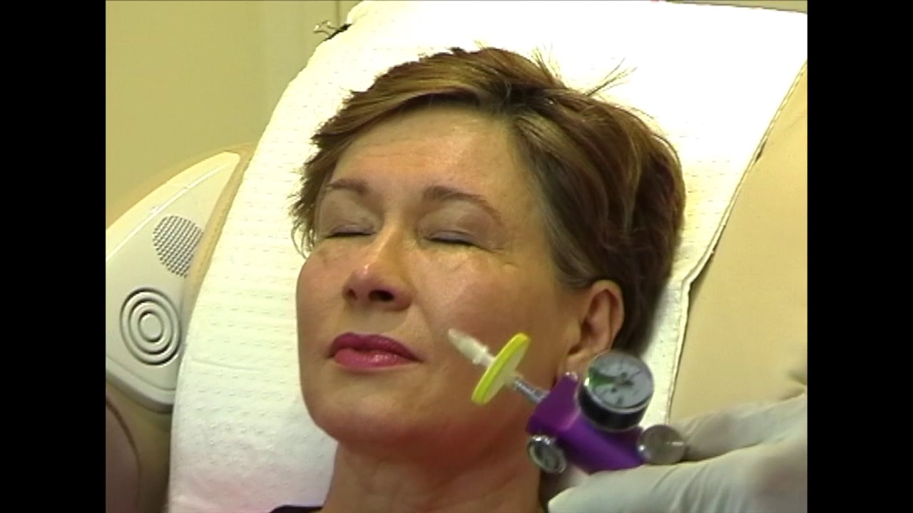 carboxy therapy