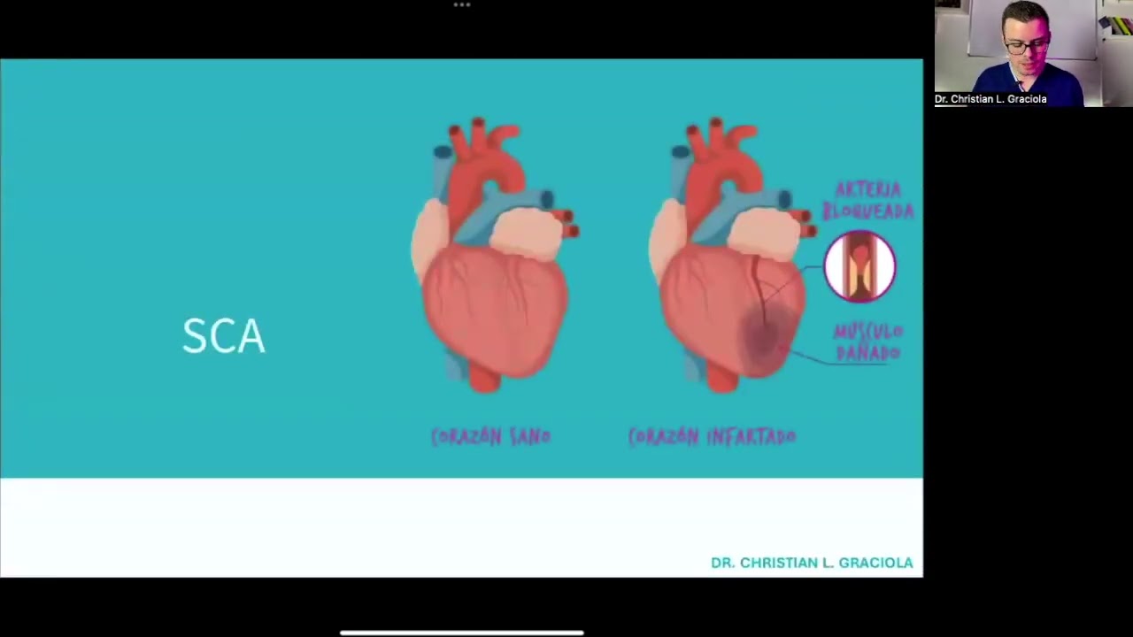 Clínica - Infarto Agudo do Miocardio