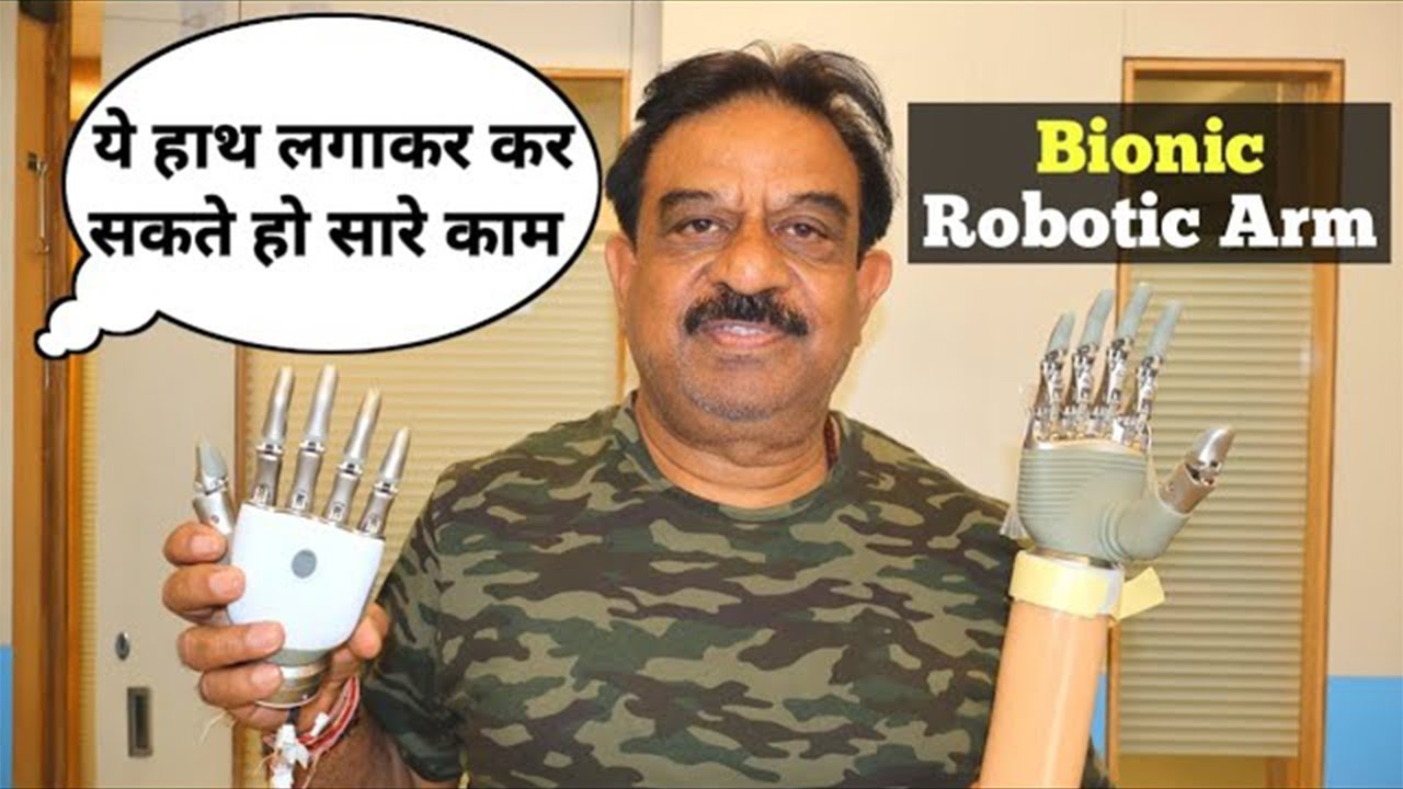 Prosthetic Hand | ये हाथ लगवाकर आप कर सकते हैं सारे काम | | P&O International Limb Center