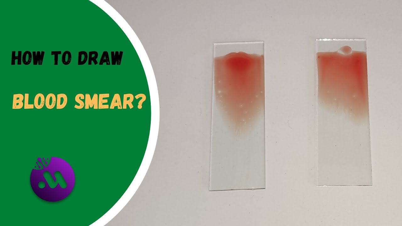 How to make blood smear? | Tutorial