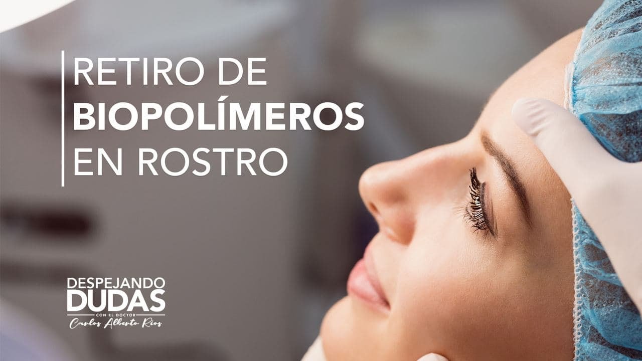 ¿Cómo se realizan las cirugías de retiro de Biopolímeros en el rostro?