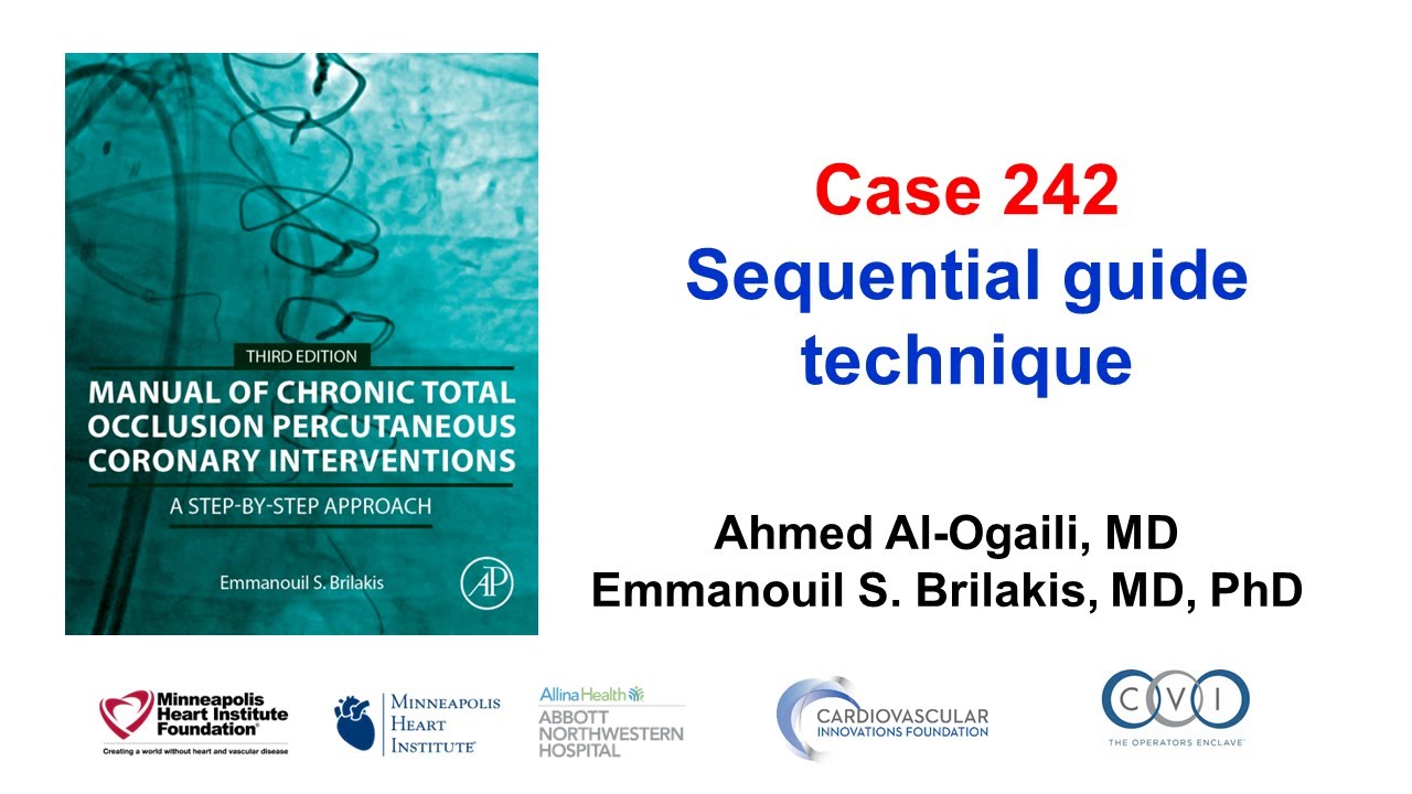 Case 242: Manual of CTO PCI - Sequential guide technique