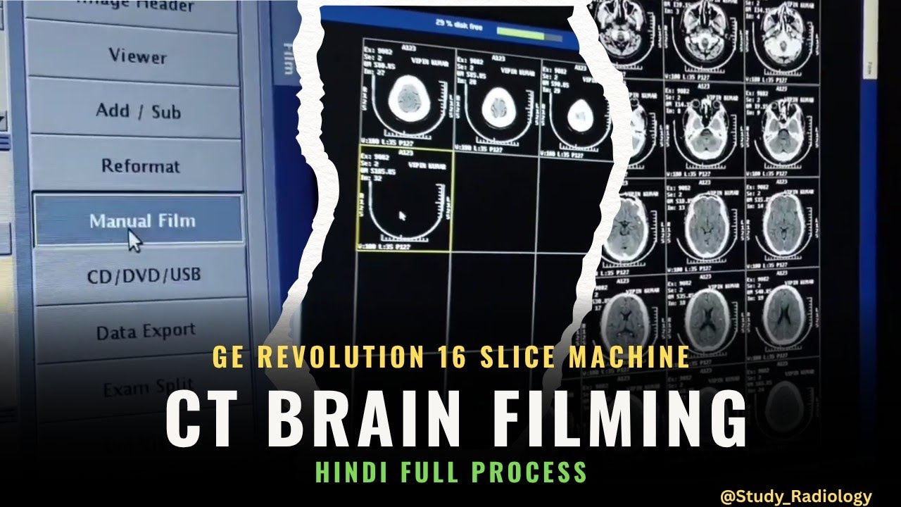 CT Brain Filming On GE Revolution 16 Slice Machine | Full Process in Hindi | @Study_Radiology 