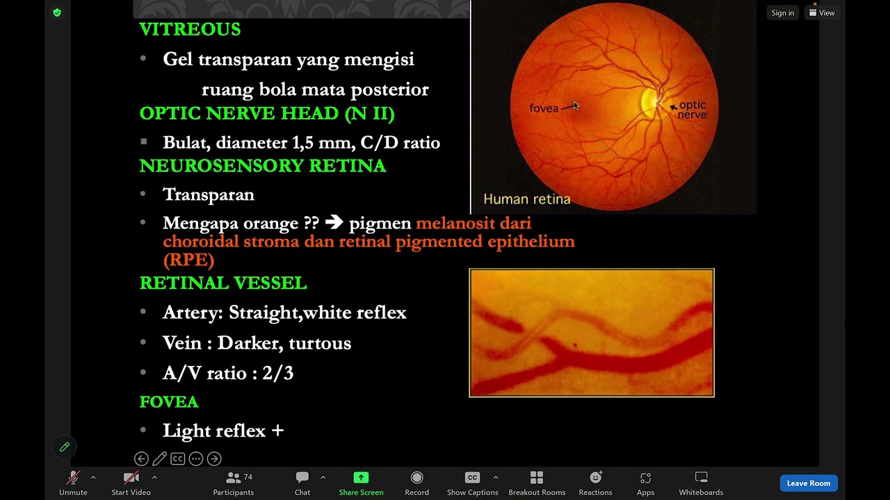 Kuliah Vitreoretina dan Macula
