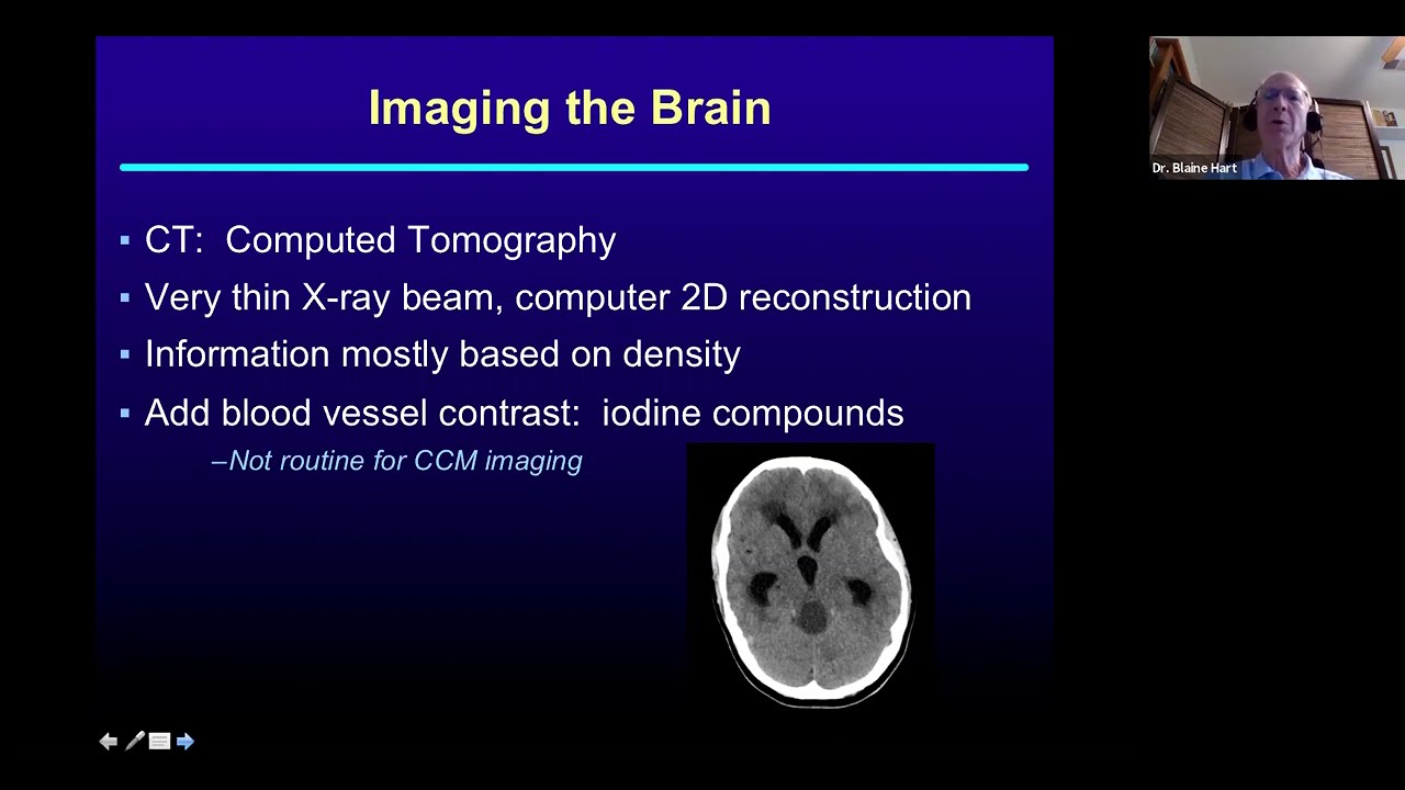 A Patient's Guide to Imaging Cerebral Cavernous Malformations