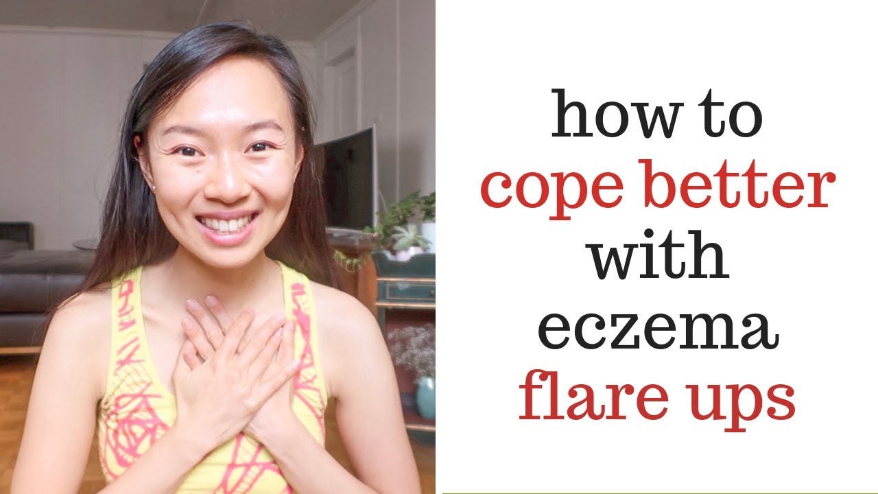 HOW to DEAL WITH ECZEMA FLARE UPS