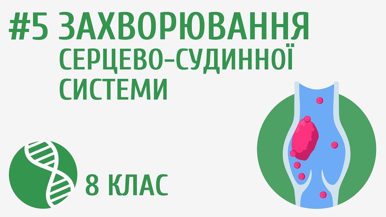 Захворювання серцево-судинної системи #5