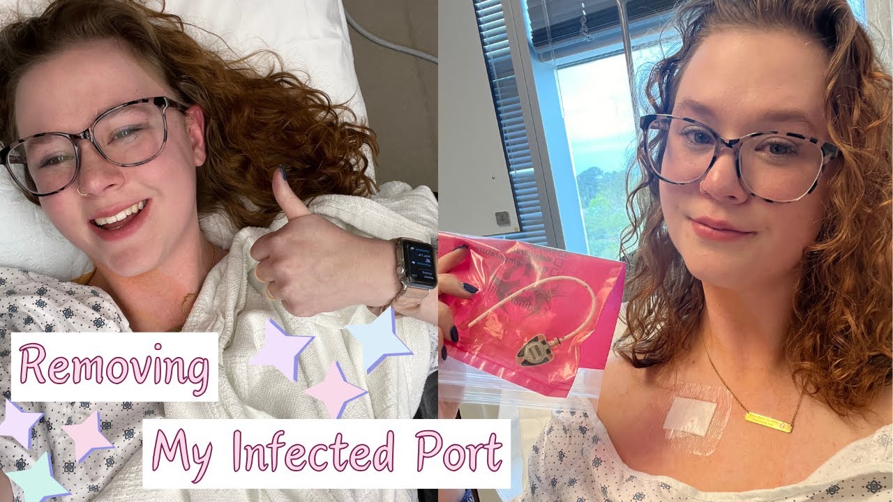 Removing My Infected Port