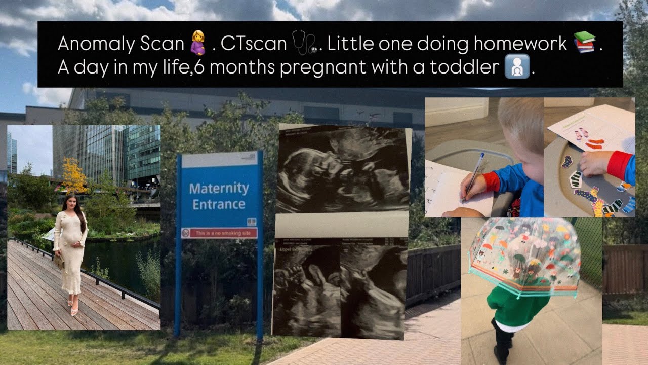 Si shkoi ekoja morfologjike🤰? Po CTScan🩺? Një ditë e imja në muajin e 6-të të shtatzanisë 🧑‍🧒🤰!