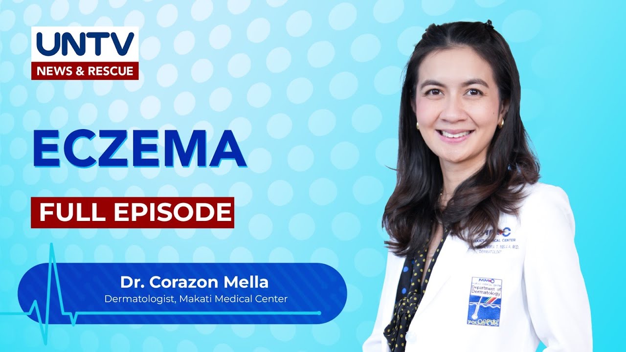 Eczema, isang seryosong kondisyon at hindi lang karaniwang pangangati ng balat