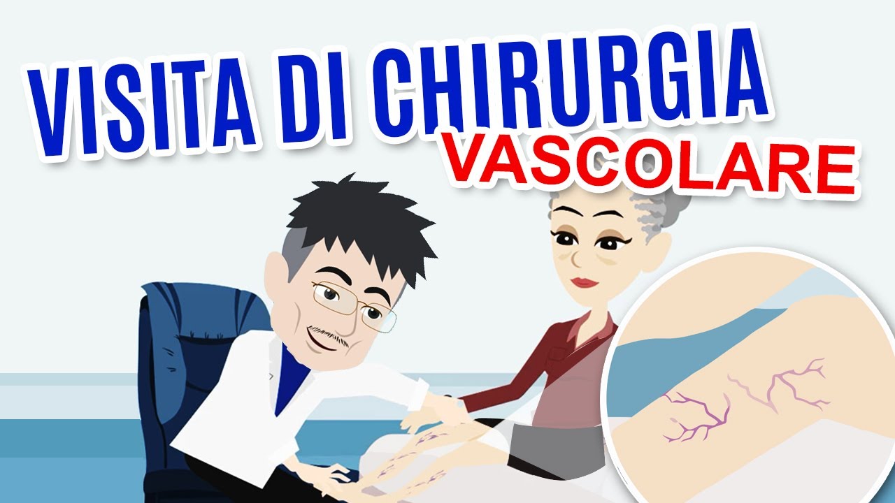 La VISITA di CHIRURGIA VASCOLARE: a cosa serve e come si svolge.