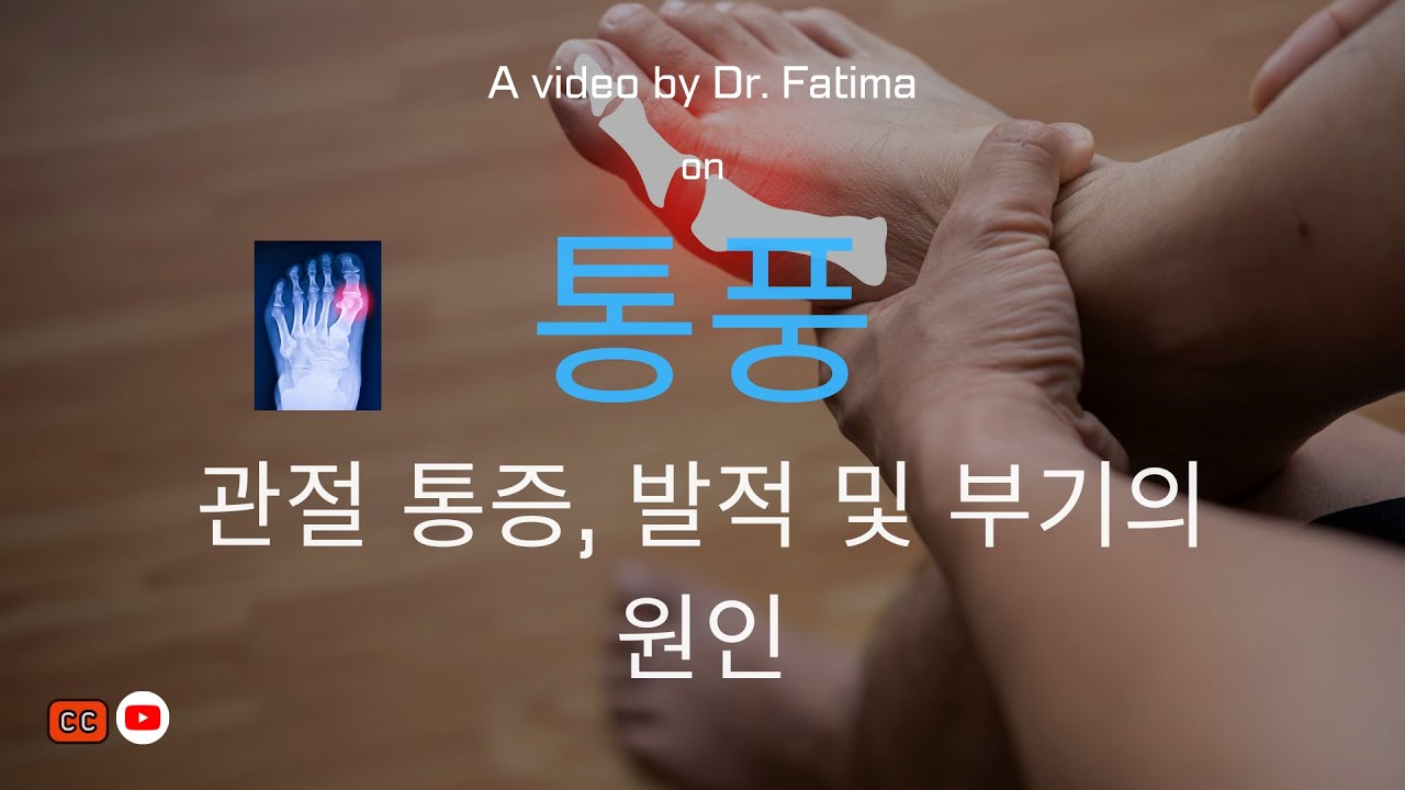 통풍 : 관절 통증, 발적 및 부기의 원인