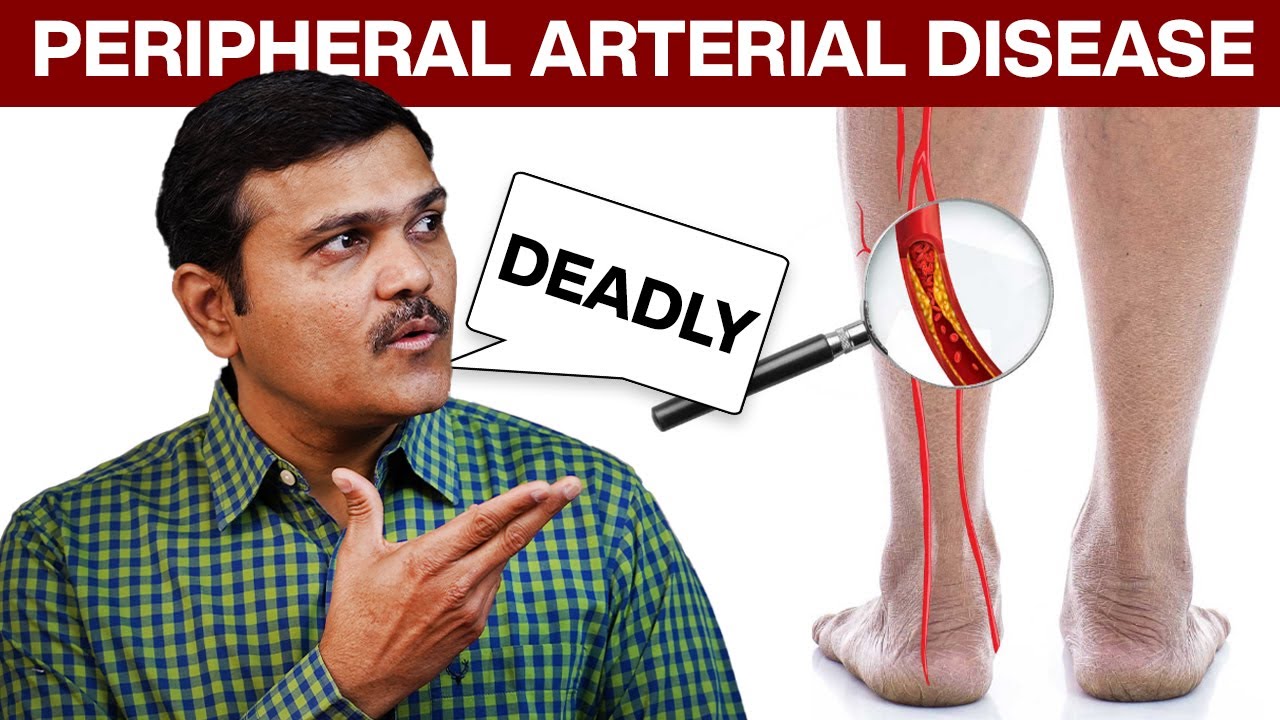 Peripheral Arterial Disease Expert Shares Lifesaving Tips You Need Now (Hindi)
