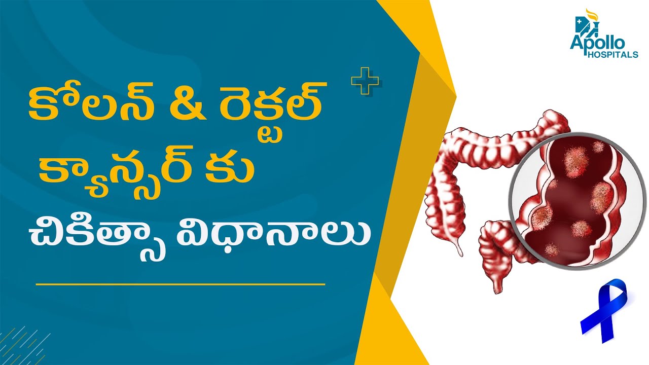 కోలన్ & రెక్టల్ క్యాన్సర్ పూర్తి వివరాలు | Colon & Rectal Cancer Awareness | Apollo Arogyamastu
