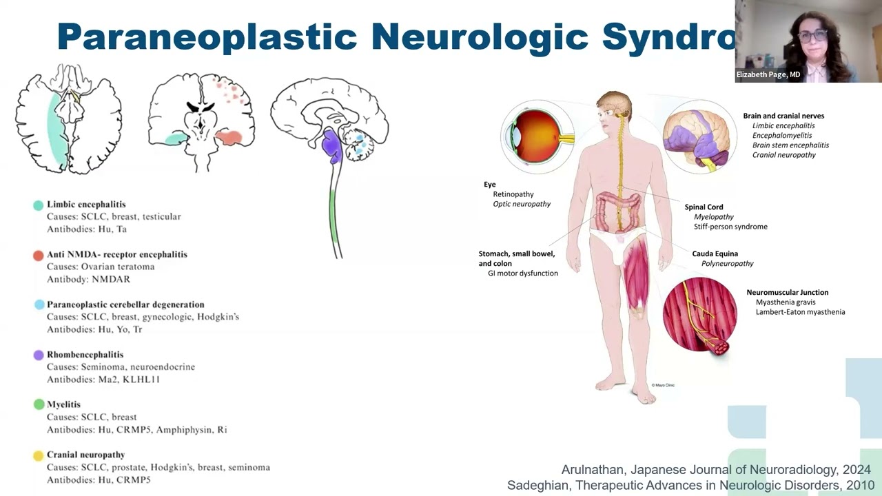 All About Paraneoplastic Cerebellar Degeneration