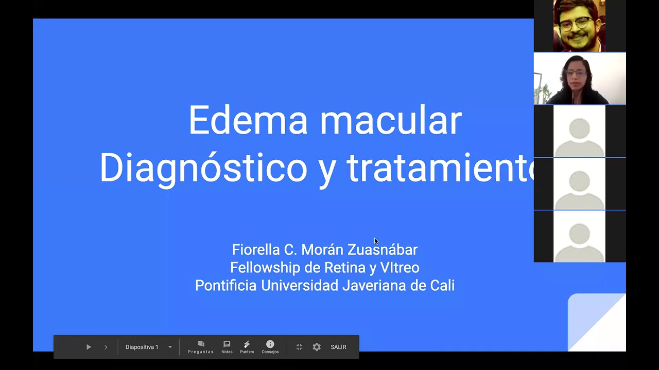 Edema macular Diagnostico y Tratamiento Dra.Fiorella C.Moran