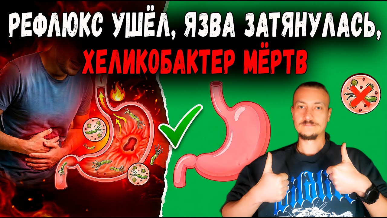 Рефлюкс, язва, хеликобактер — не приговор