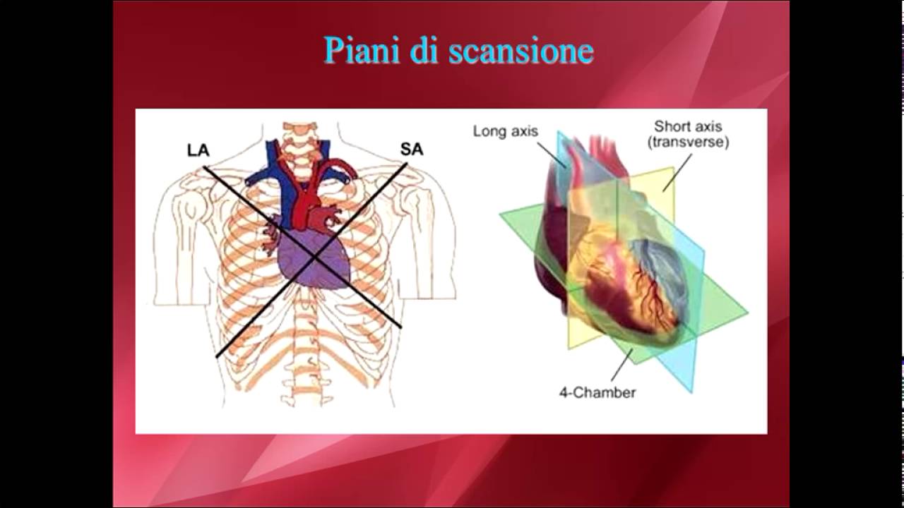Elementi di ecocardiografia: IV video,  anatomia, proiezioni, primo approccio pratico.