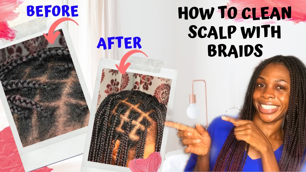 HOW TO CLEAN SCALP WITH BRAIDS WITHOUT WASHING | KNOTLESS BOX BRAIDS