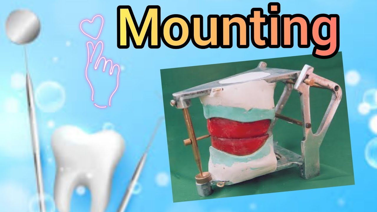 Mounting